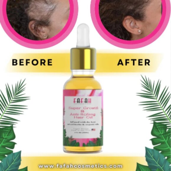 The Fafah Super Growth & Anti-Itching Hair Oil (4 oz) - Picture 2 of 10